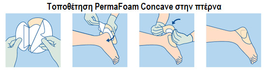 ΕΠΙΘΕΜΑ ΓΙΑ ΚΑΤΑΚΛΙΣΗ ΠΤΕΡΝΑΣ HARTMANN PERMAFOAM CONCAVE